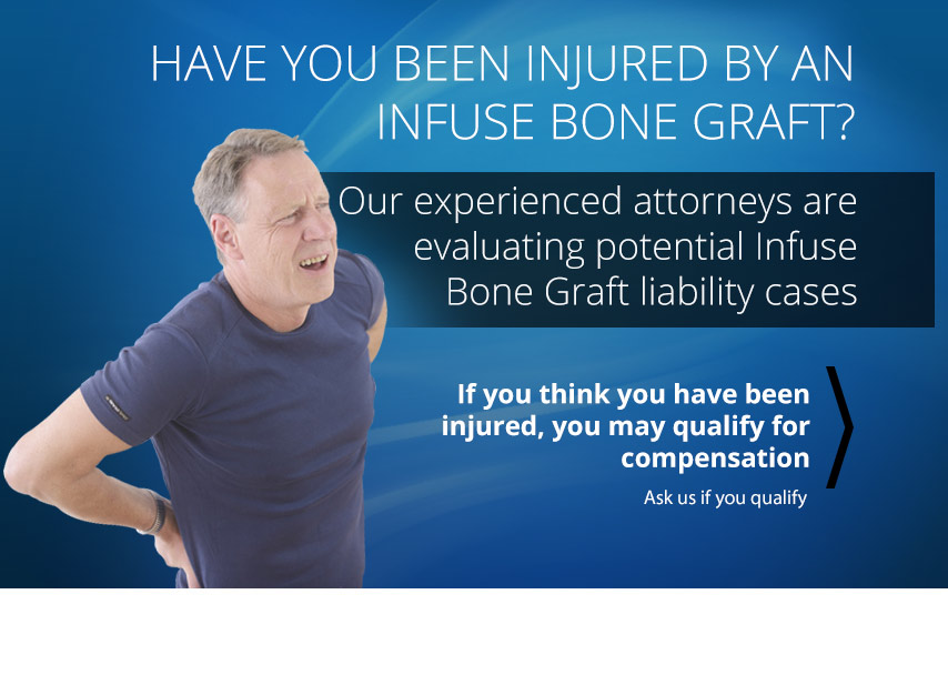 Have You Been Injured by an Infuse Bone Graft?